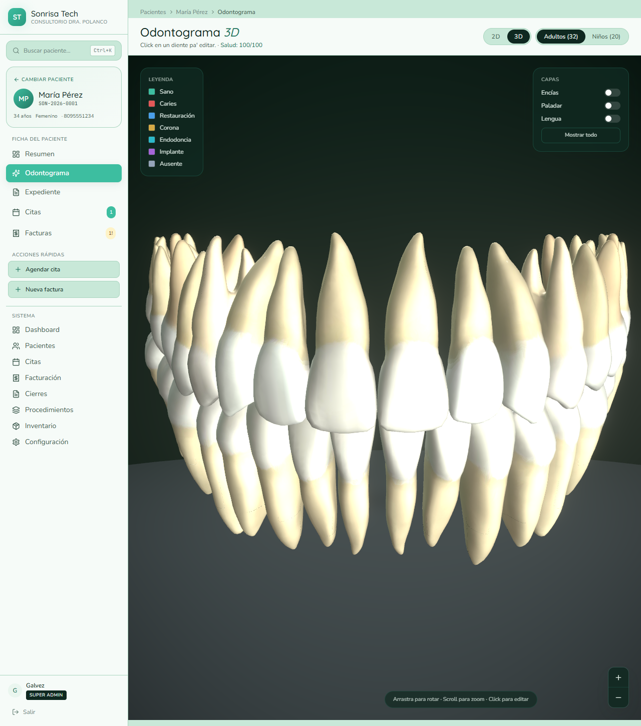 Odontograma 3D real de Sonrisa Tech