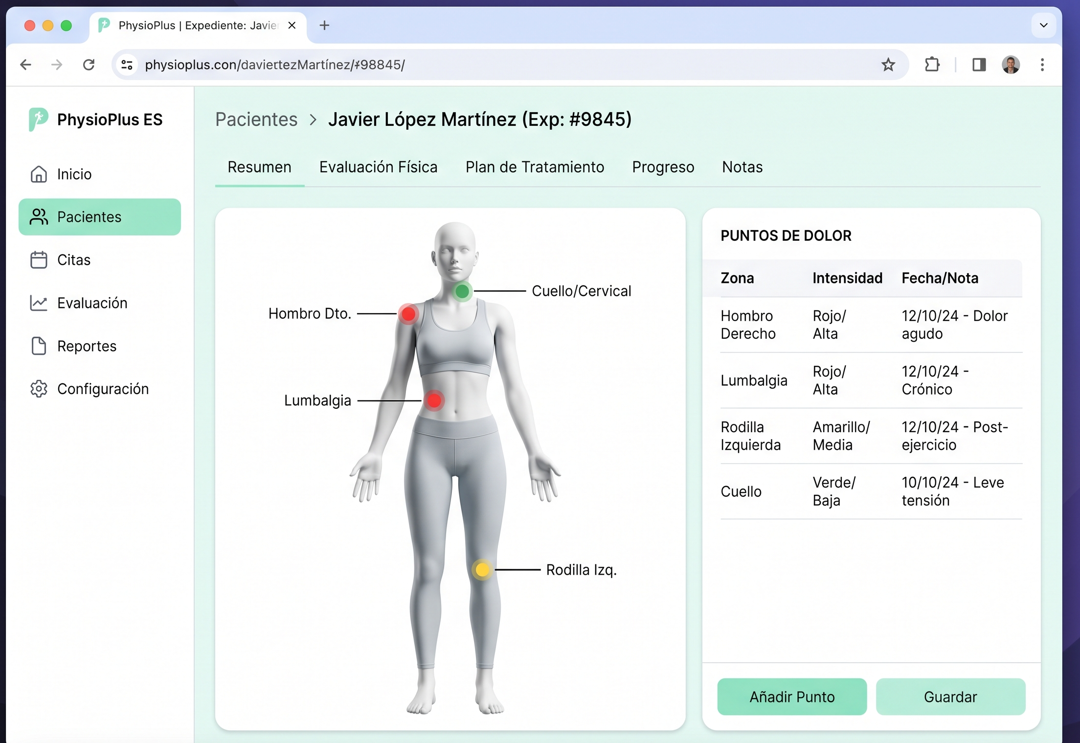 Sistema de fisioterapia con mapa corporal