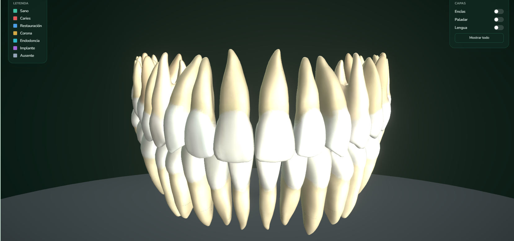 Odontograma 3D real de Sonrisa Tech